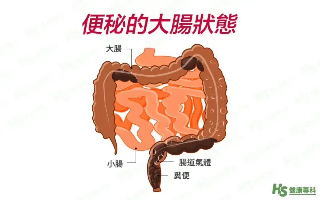 640?wx_fmt=jpeg&from=appmsg#imgIndex=5